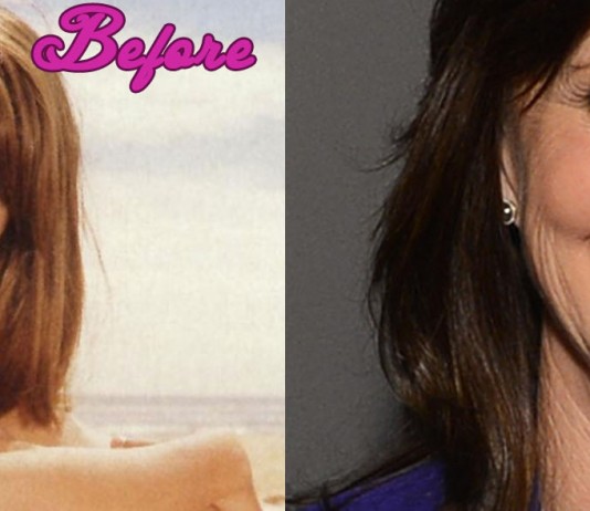 Sally Field Plastic Surgery Pictures