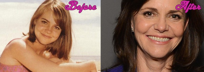 Sally Field Plastic Surgery Pictures