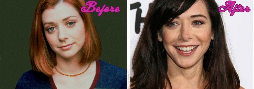 Alyson Hannigan Plastic Surgery Pictures