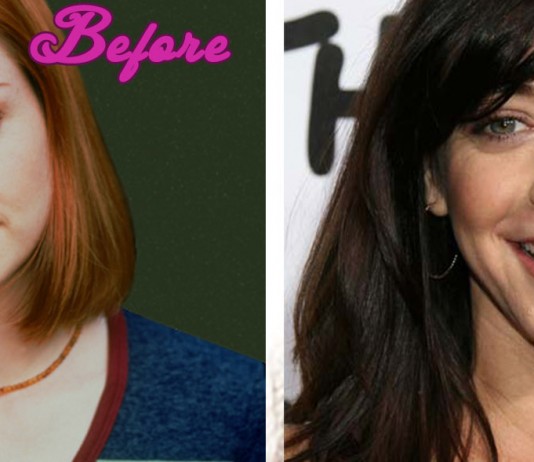 Alyson Hannigan Plastic Surgery Pictures