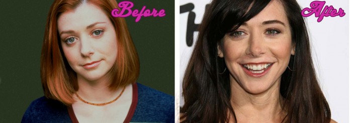 Alyson Hannigan Plastic Surgery Pictures