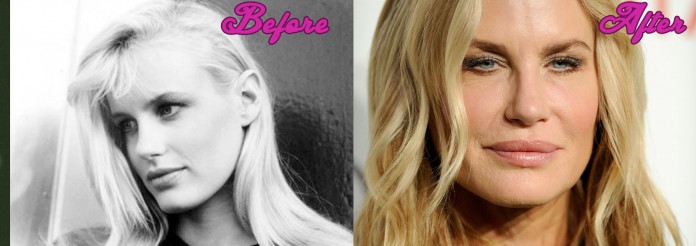 Daryl Hannah Plastic Surgery Gone Wrong Photos