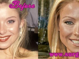 Kelly Ripa Plastic Surgery nose job and botox