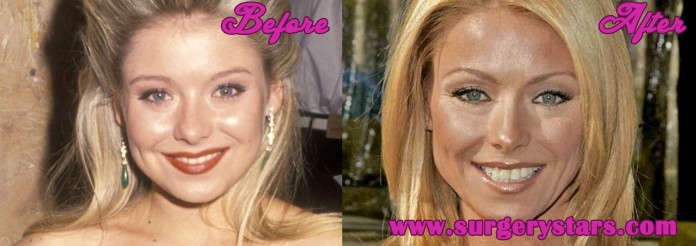 Kelly Ripa Plastic Surgery nose job and botox