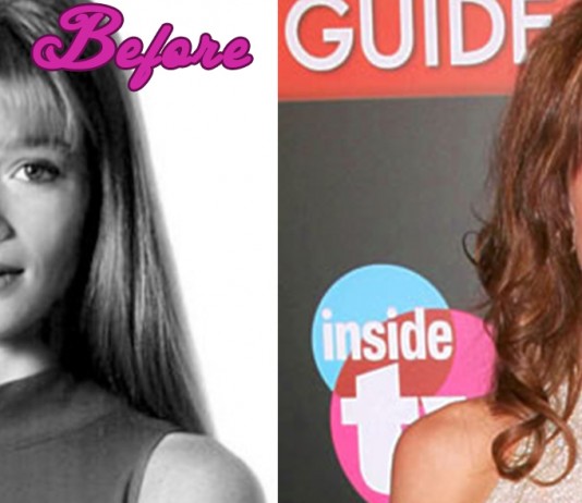 Lauren Holly Plastic Surgery... Or not?