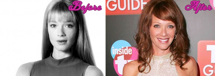 Lauren Holly Plastic Surgery... Or not?