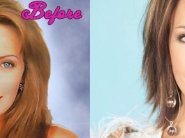 Hunter Tylo Plastic Surgery Before and After