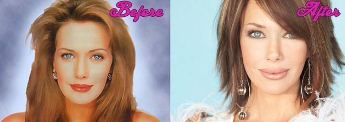 Hunter Tylo Plastic Surgery Before and After