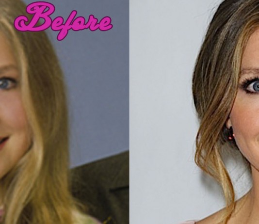 Sarah Chalke Plastic Surgery Photos
