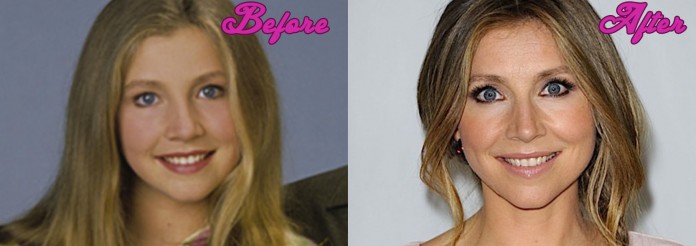 Sarah Chalke Plastic Surgery Photos