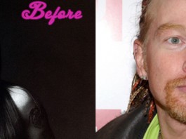 The Axl Rose Plastic Surgery - Celebrity Makeover