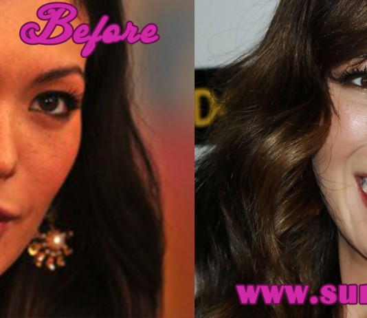 Lindsay Price Plastic Surgery
