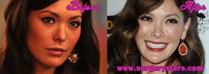 Lindsay Price Plastic Surgery