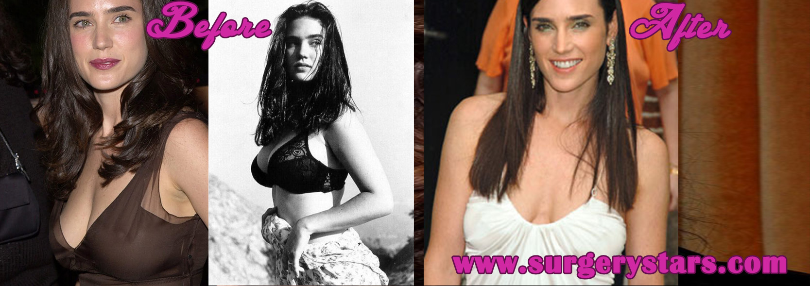 Jennifer Connelly Breast Reduction