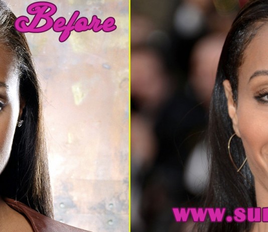 Jada Pinkett plastic surgery