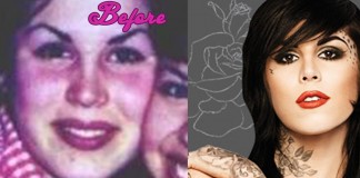 With Kat Von D Plastic Surgery Before and After Pics