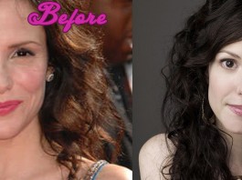 Mary Louise Parker Plastic Surgery Pics