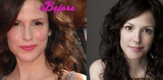 Mary Louise Parker Plastic Surgery Pics