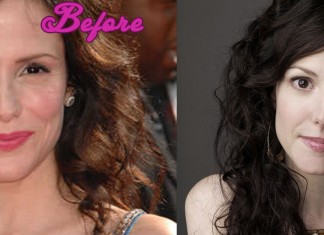 Mary Louise Parker Plastic Surgery Pics