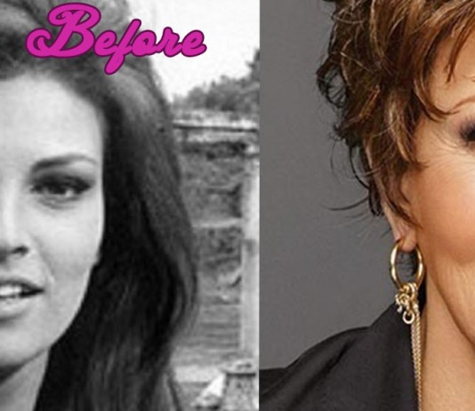 Raquel Welch Plastic Surgery Pics