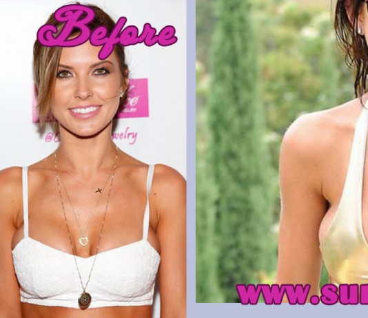 Audrina+Patridge boobs breast surgery