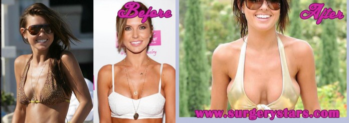 Audrina+Patridge boobs breast surgery