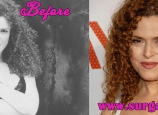 Bernadette Peters sugery pictures