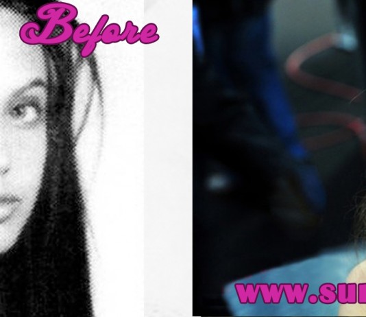 Angelina Jolie Plastic Surgery Before and After Pics