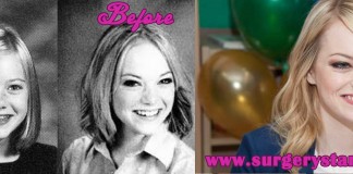 Emma Stone before and after final