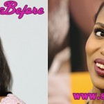 Kerry Washington Before and After Plastic Surgery Photos