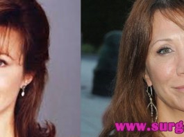 cherry otteri plastic sugery
