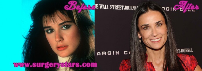 demi moore surgery