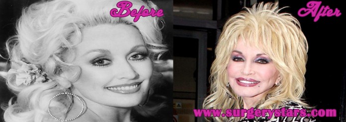 dolly parton before plastic surgery