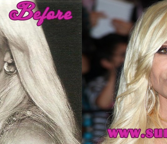 donatella versace before plastic surgery
