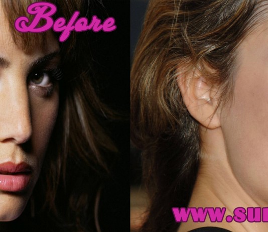 erica durance plastic surgery