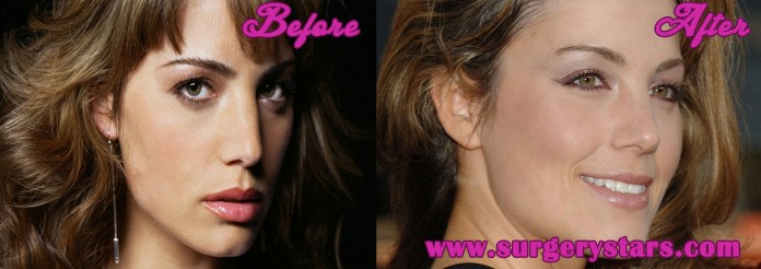 erica durance plastic surgery