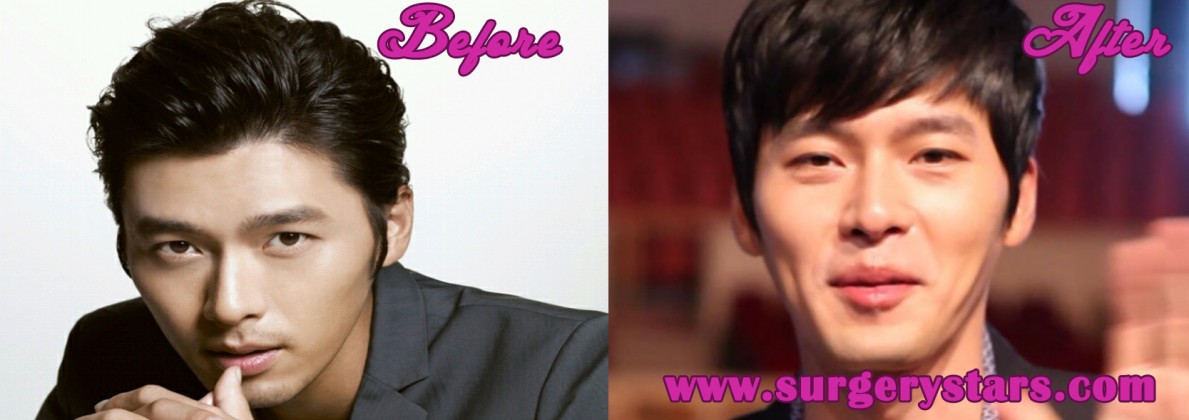 Hyun Bin Plastic Surgery Before And After Shoots
