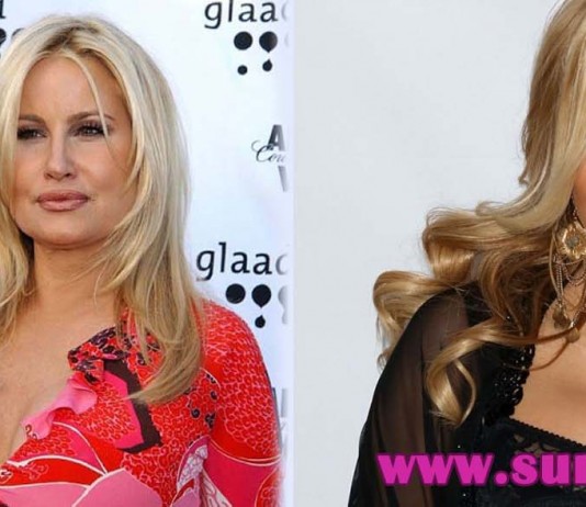 jennifer coolidge plastic surgery