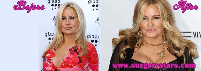 jennifer coolidge plastic surgery