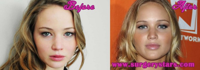 jennifer garner lips before and after