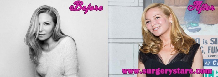 jennifer westfeldt plastic surgery