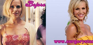 julie benz before and after sugery