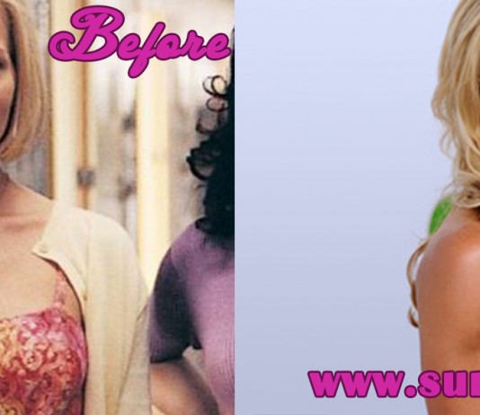 julie benz before and after sugery