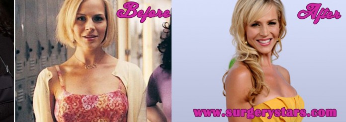 julie benz before and after sugery