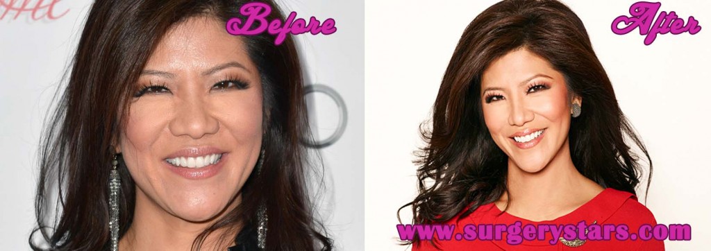 Julie Chen Plastic Surgery Photos Before After Surgery | Hot Sex Picture