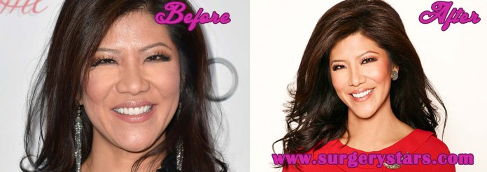 julie chen plastic surgery