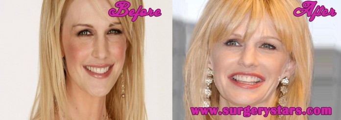 kathryn morris plastic surgery