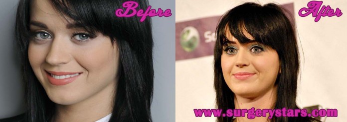 katy perry plastic surgery