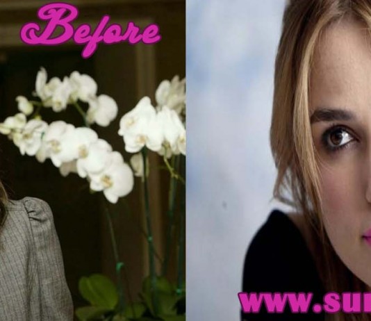 keira knightley plastic surgery