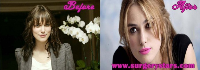 keira knightley plastic surgery